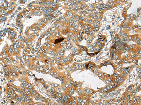 CHCHD3 Polyclonal Antibody - image 1