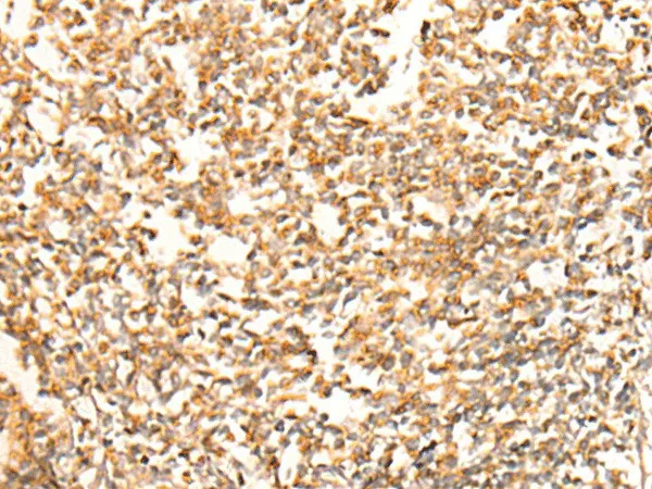 CHCHD3 Polyclonal Antibody - image 2