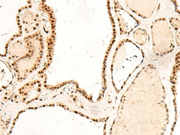 RMND5B Polyclonal Antibody - image 1