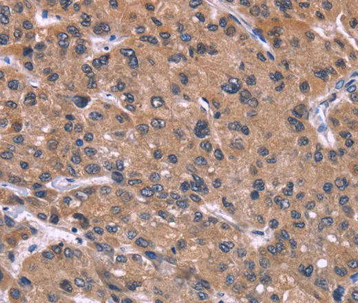 HSD11B2 Polyclonal Antibody - image 1