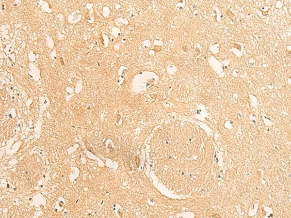 IFITM2 Polyclonal Antibody - image 1