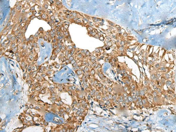 BRD9 Polyclonal Antibody - image 1