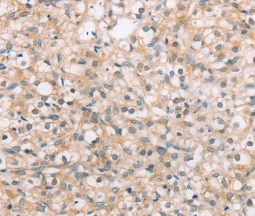 ROR1 Polyclonal Antibody - image 1
