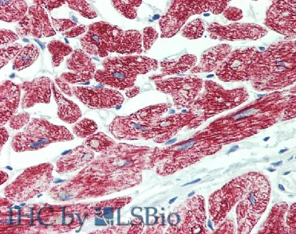 ROR1 Polyclonal Antibody - image 2