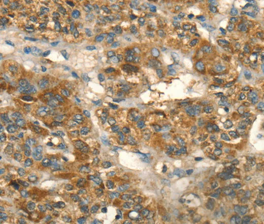 HSD17B8 Polyclonal Antibody - image 1