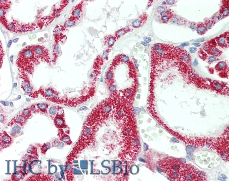 HSD17B8 Polyclonal Antibody - image 2