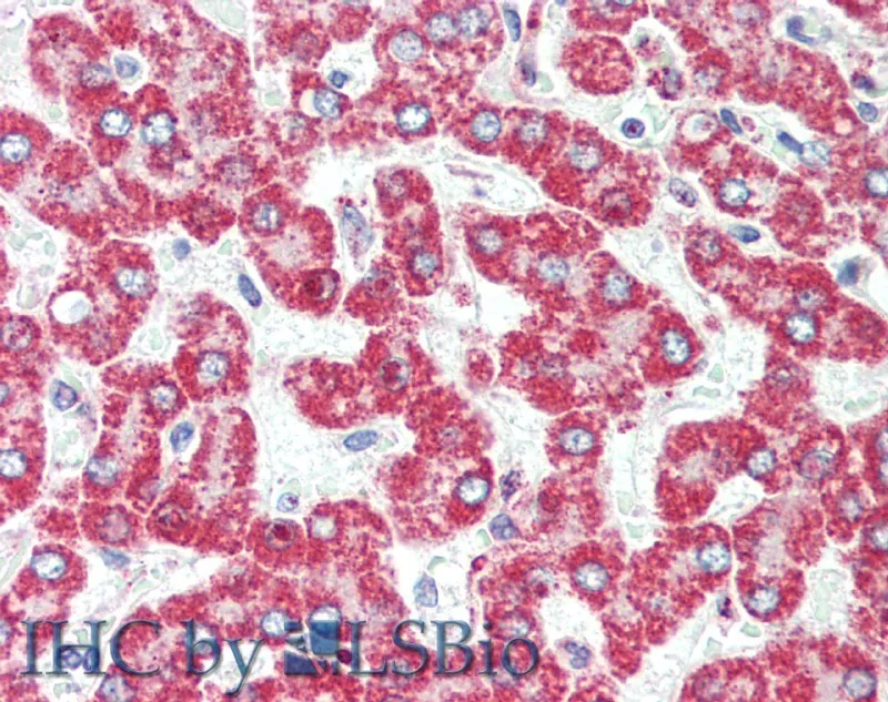 HSD17B8 Polyclonal Antibody - image 3