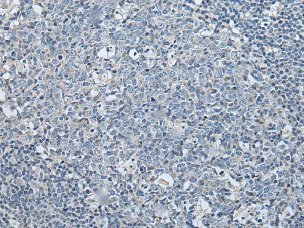 LASP1 Polyclonal Antibody - image 1