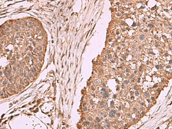 PER3 Polyclonal Antibody - image 1
