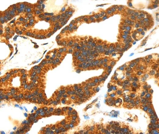 SMYD4 Polyclonal Antibody - image 1