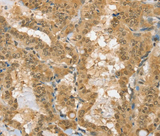 PSMC1 Polyclonal Antibody - image 1