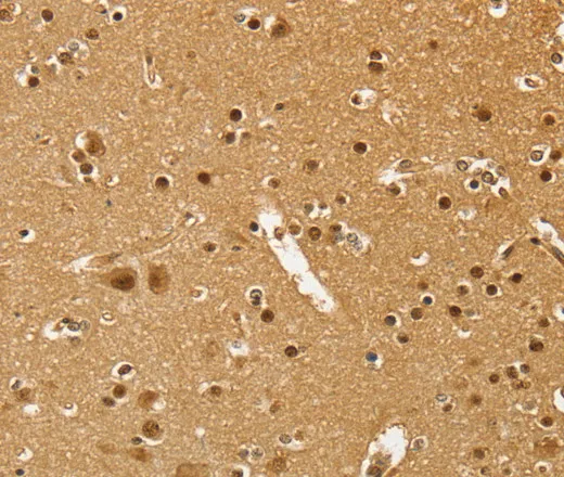 PSMC1 Polyclonal Antibody - image 2