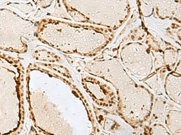 IPO11 Polyclonal Antibody - image 1