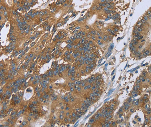 CERS4 Polyclonal Antibody - image 1