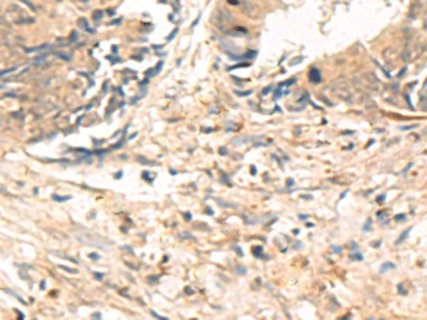 ABHD2 Polyclonal Antibody - image 1