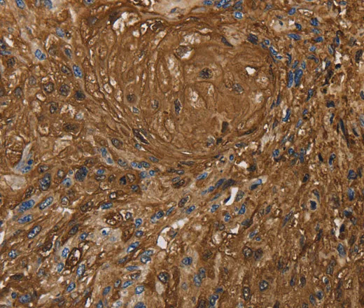 ITPR3 Polyclonal Antibody - image 1