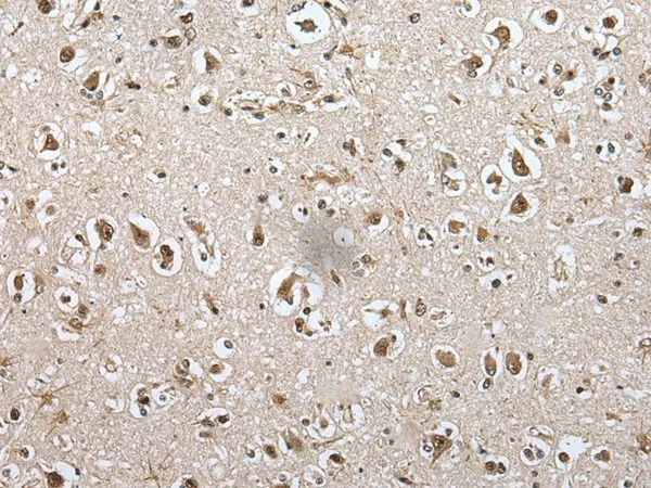 METAP1D Polyclonal Antibody - image 1