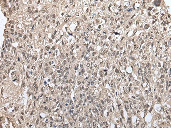 METAP1D Polyclonal Antibody - image 2