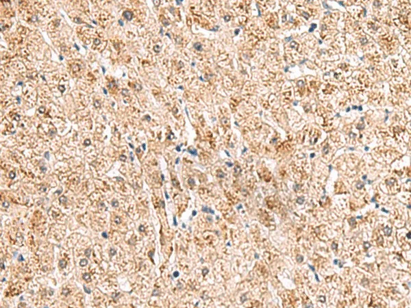 HCCS Polyclonal Antibody - image 1