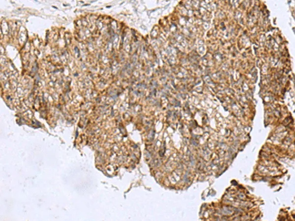 HCCS Polyclonal Antibody - image 2