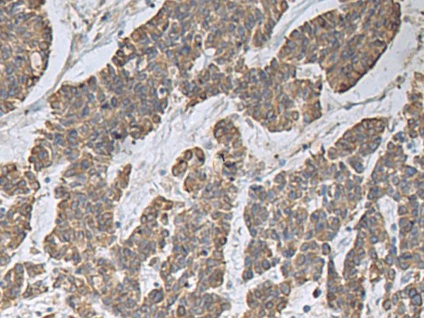 CCNF Polyclonal Antibody - image 1