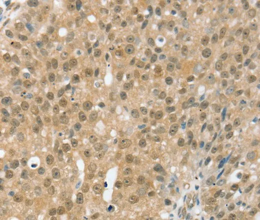 TRIM35 Polyclonal Antibody - image 1