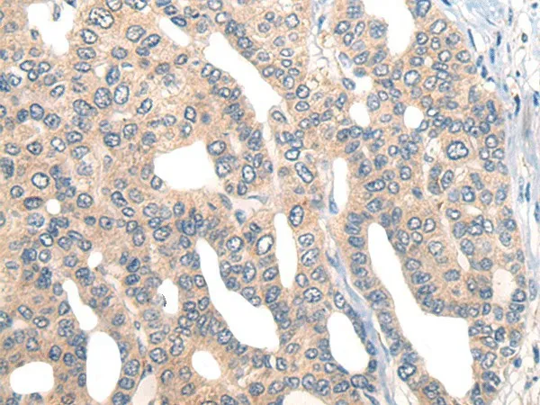 CORO2B Polyclonal Antibody - image 1