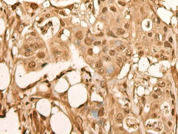 BRF2 Polyclonal Antibody - image 1