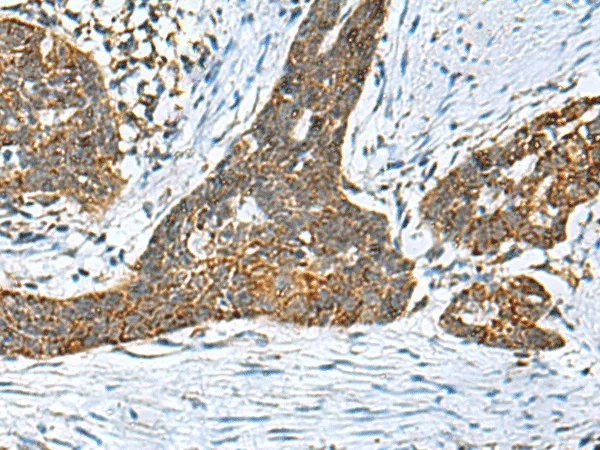 PREPL Polyclonal Antibody - image 1