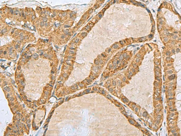 PREPL Polyclonal Antibody - image 2
