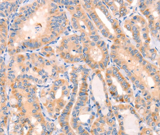 CD109 Polyclonal Antibody - image 1