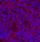 Cyclin E1 Polyclonal Antibody - image 1