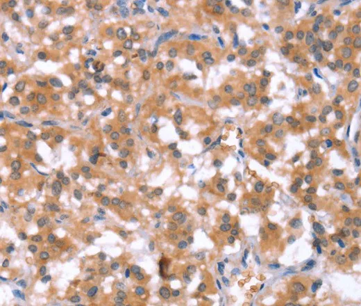 HCAR2 Polyclonal Antibody - image 1