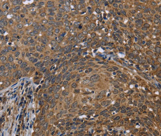 FHIT Polyclonal Antibody - image 1