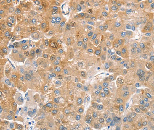CDR2 Polyclonal Antibody - image 1