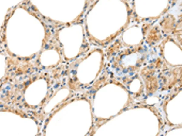 RAB11A Polyclonal Antibody - image 1