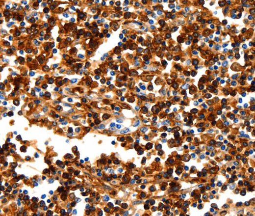NCOR1 Polyclonal Antibody - image 1