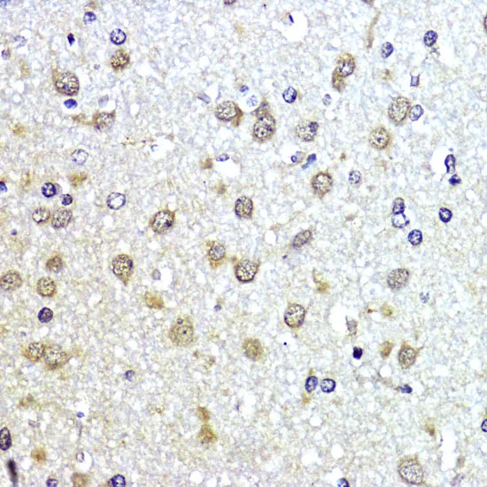 SUMO1 Polyclonal Antibody - image 2
