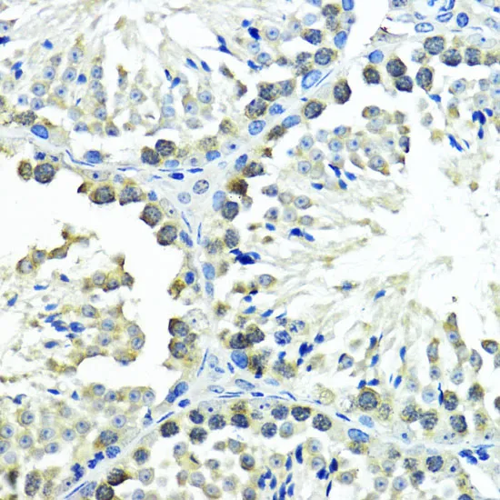 SUMO1 Polyclonal Antibody - image 3