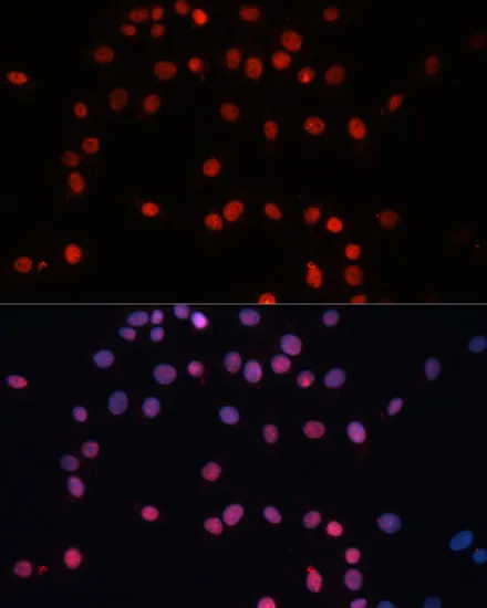 SUMO1 Polyclonal Antibody - image 4