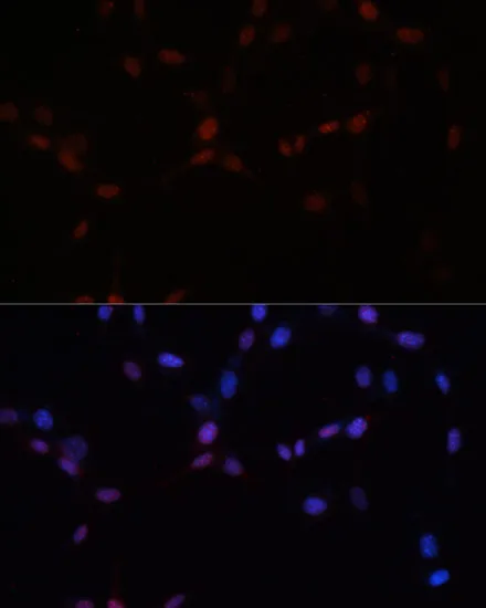SUMO1 Polyclonal Antibody - image 5