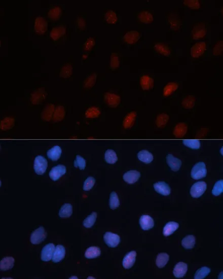 SUMO1 Polyclonal Antibody - image 6