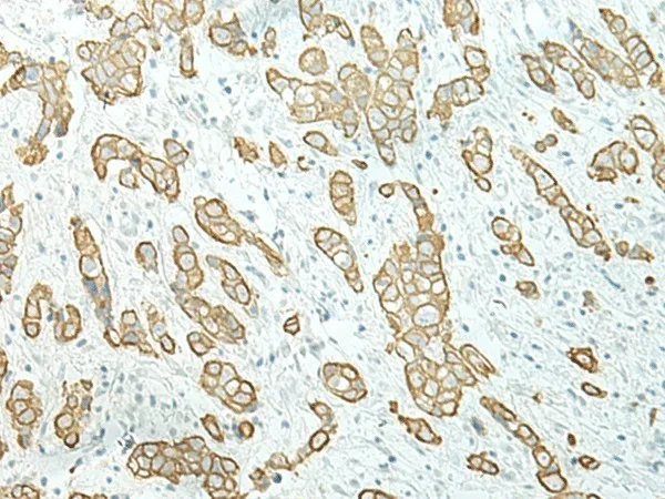 ETAA1 Polyclonal Antibody - image 1