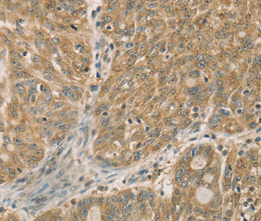 DMRT3 Polyclonal Antibody - image 1