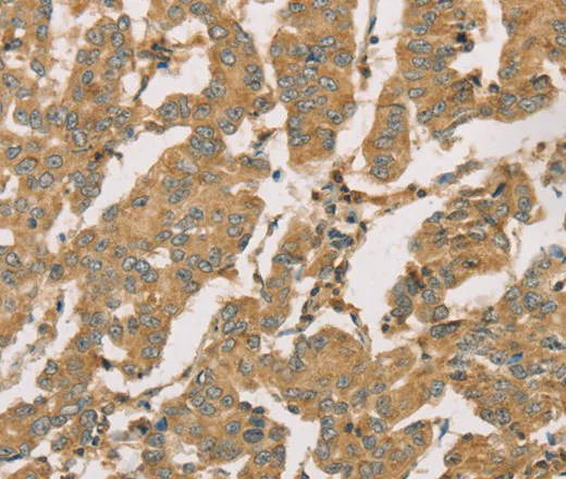 DMRT3 Polyclonal Antibody - image 2