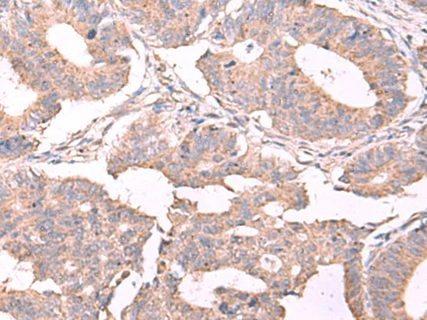 ESM1 Polyclonal Antibody - image 1