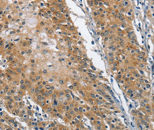 TRIP4 Polyclonal Antibody - image 1