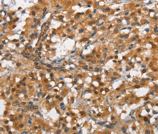 CD13 Polyclonal Antibody - image 1