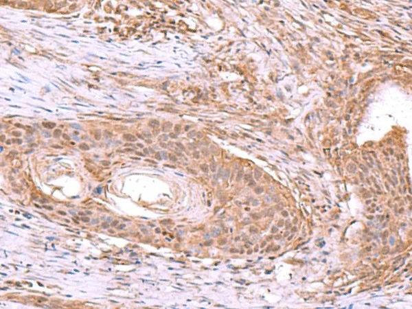 JDP2 Polyclonal Antibody - image 1