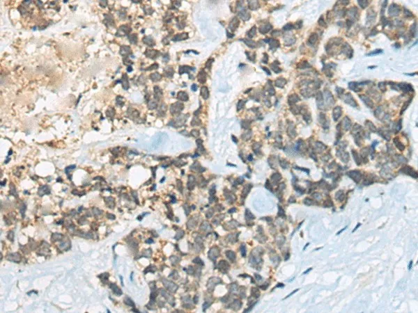 BACE2 Polyclonal Antibody - image 1